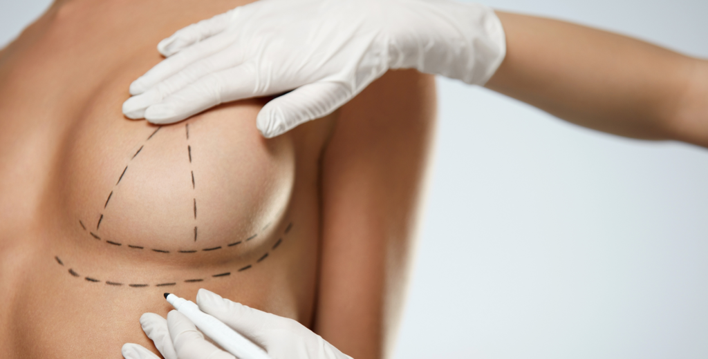 Benefits of Breast Lift Surgery